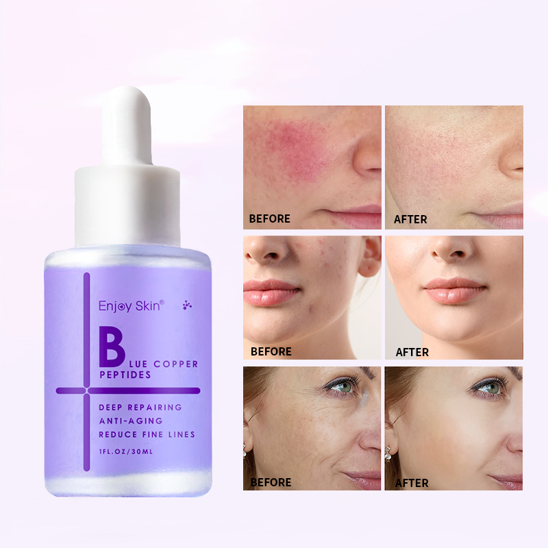Organic Vegan Facial Skin Care Serum - Treasured Gift's & More