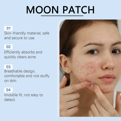 Moon Acne Patch - Treasured Gift's & More